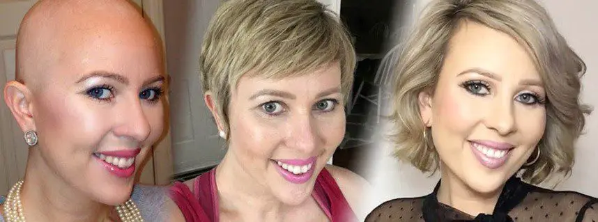 Short Hair After Chemo _ Growth Timelines