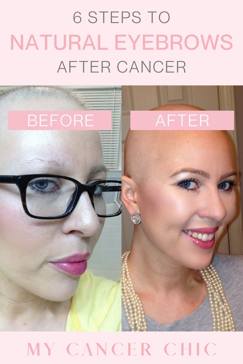 How to Create Natural Eyebrows for Cancer Fighters _Chemotherapy brows