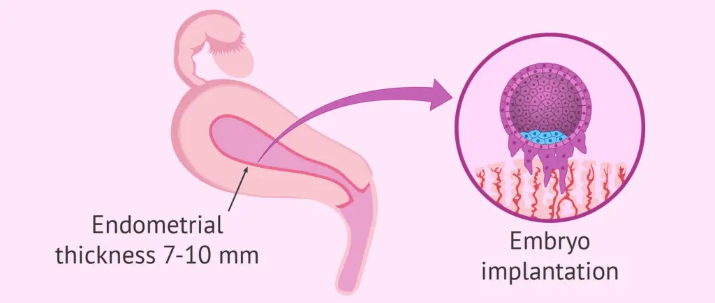 FET Cycle_Thicken Uterine Lining :Implantation