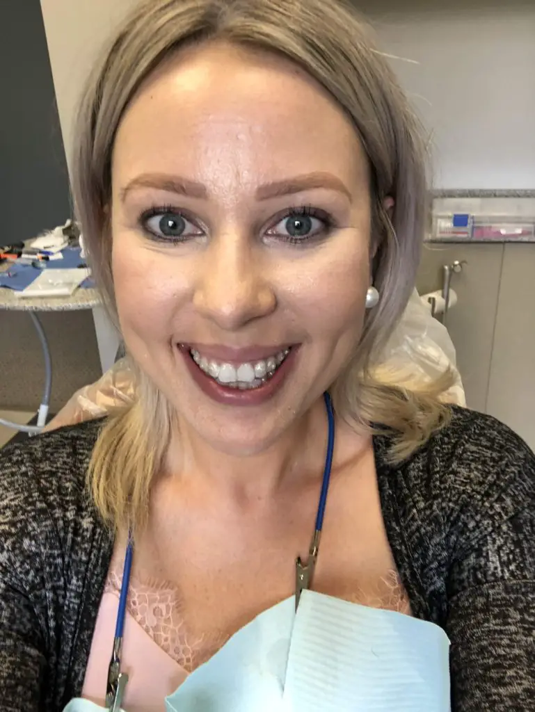 Invisalign Consultation 