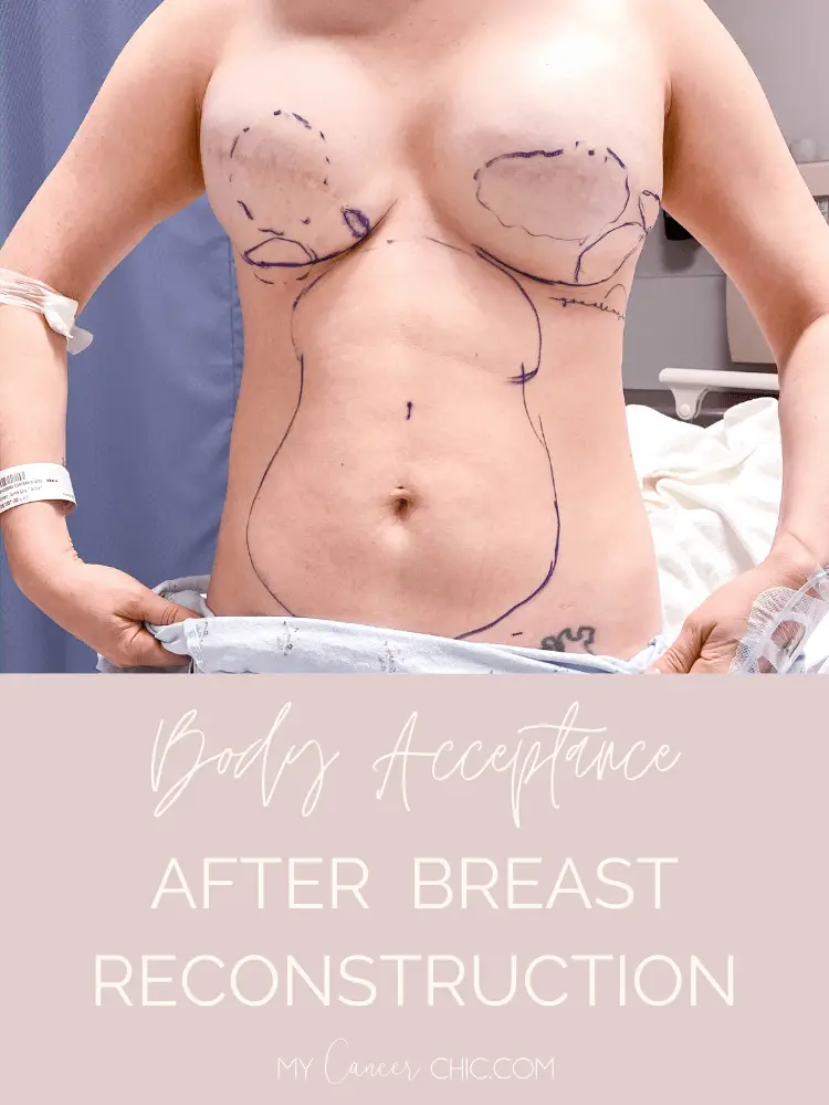 Acceptance After Breast Reconstruction_woman with plastic surgery markings