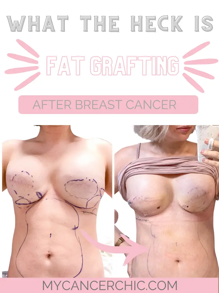 woman showing how to prepare for Fat Grafting After Breast Reconstruction_Comparison