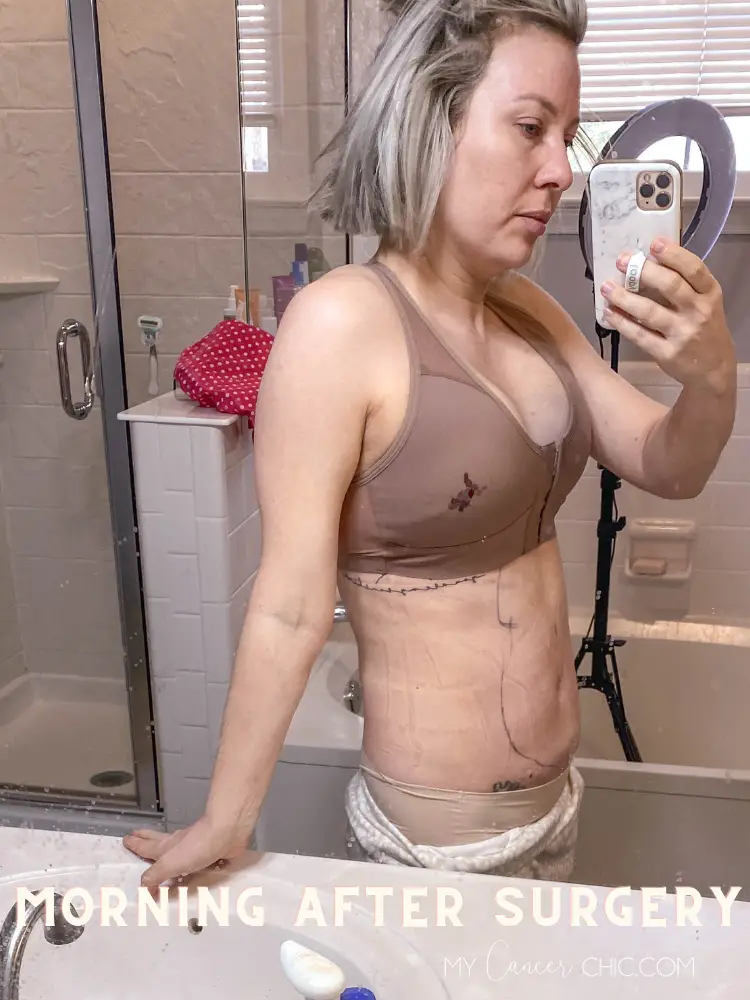 woman showing body after Fat Grafting After Breast