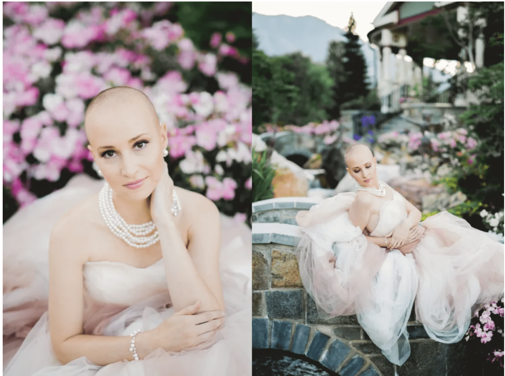 Breast cancer survivor photoshoot inspiration _bald is beautiful